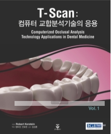 T-Scan: 컴퓨터 교합분석기술의 응용 Vol.1